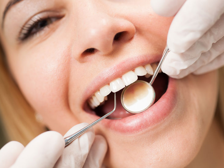 Làm sạch Răng: Hướng dẫn Lấy Cao răng Chuyên nghiệp tại Nha sĩ