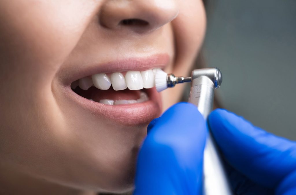 Làm sạch Răng: Hướng dẫn Lấy Cao răng Chuyên nghiệp tại Nha sĩ