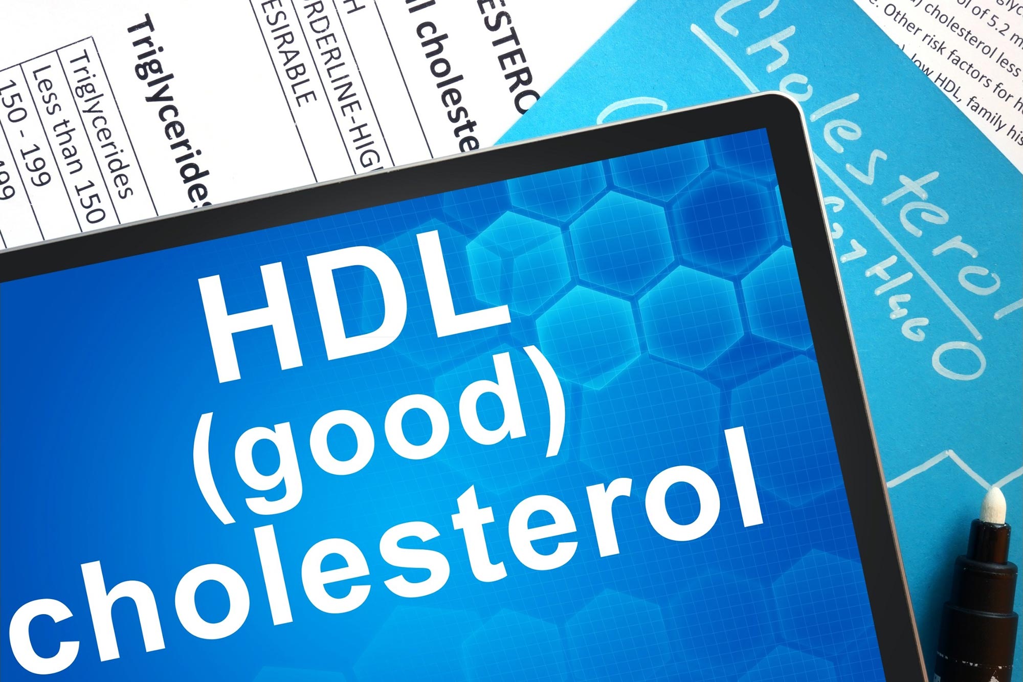 Nguyên nhân nào gây ra mức cholesterol HDL thấp?