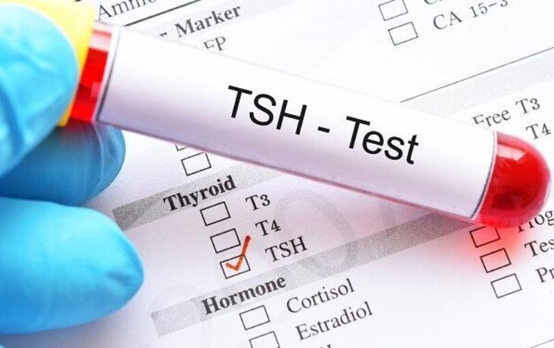Phạm vi, triệu chứng và ý nghĩa của mức TSH là gì?