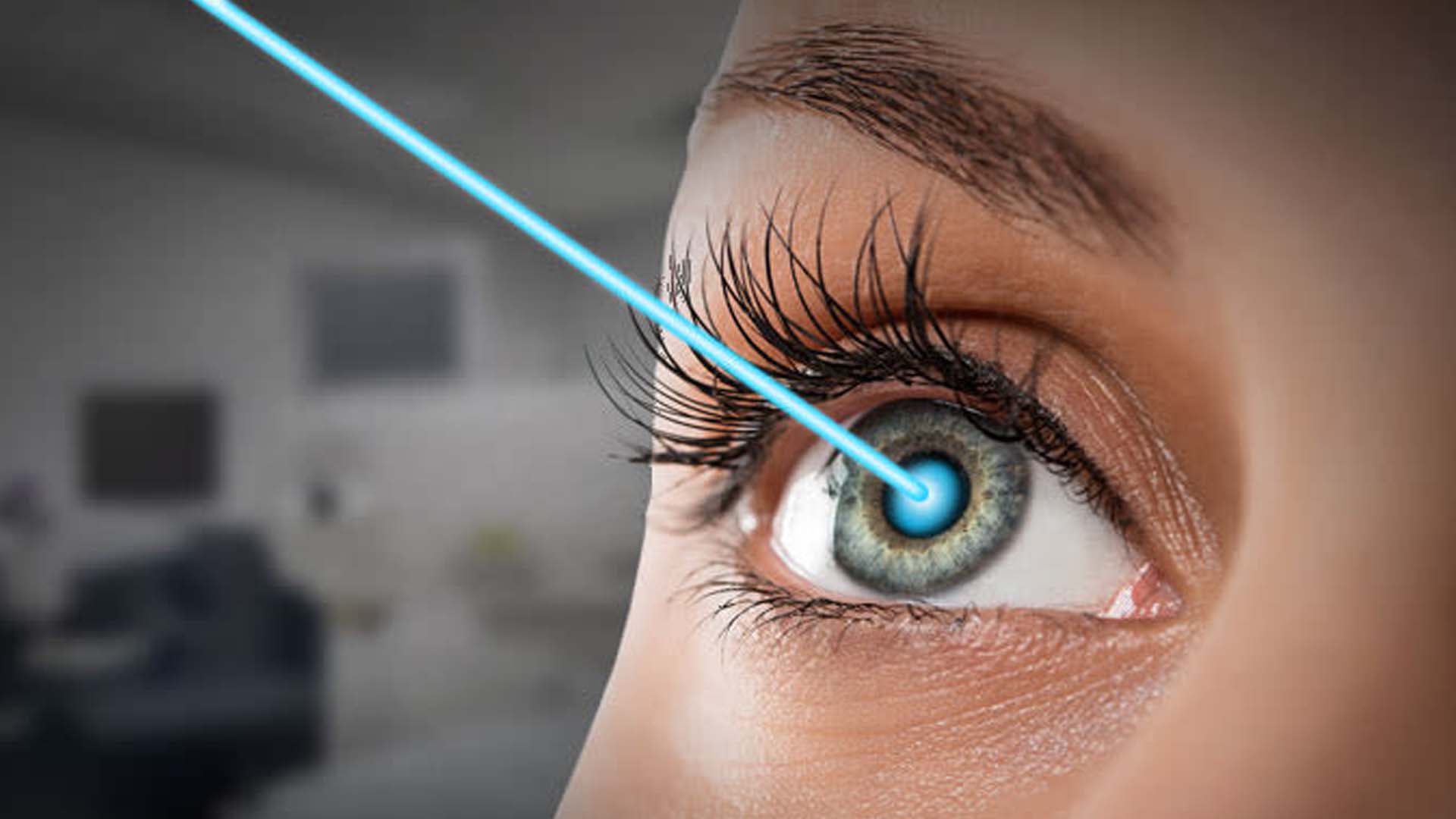 Tìm hiểu về phẫu thuật mắt LASIK
