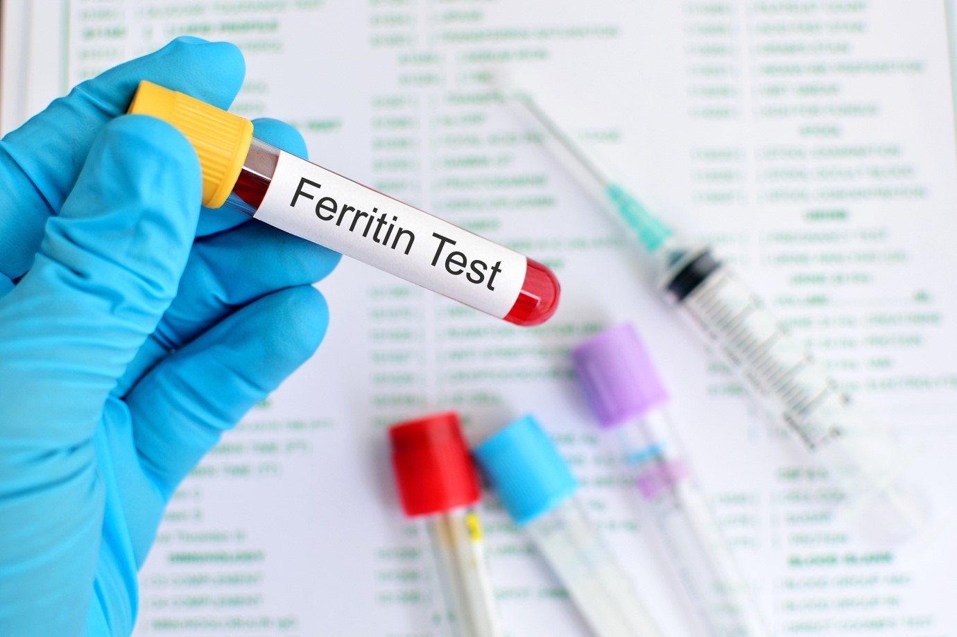 Xét nghiệm nồng độ Ferritin trong máuXét nghiệm nồng độ Ferritin trong máu
