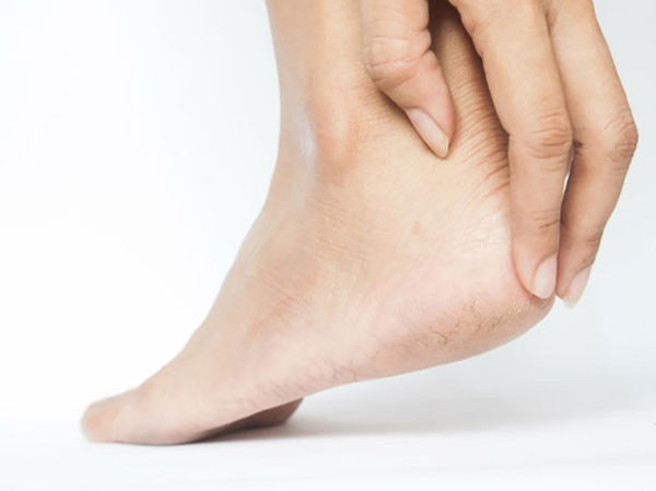 Biện pháp khắc phục tốt nhất cho da chân khô