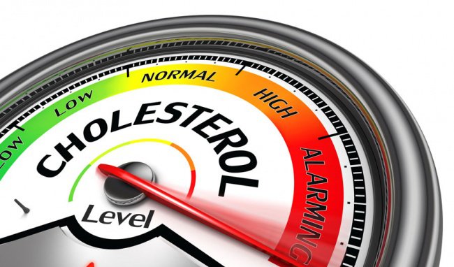 Mức cholesterol của tôi nên ở mức nào?