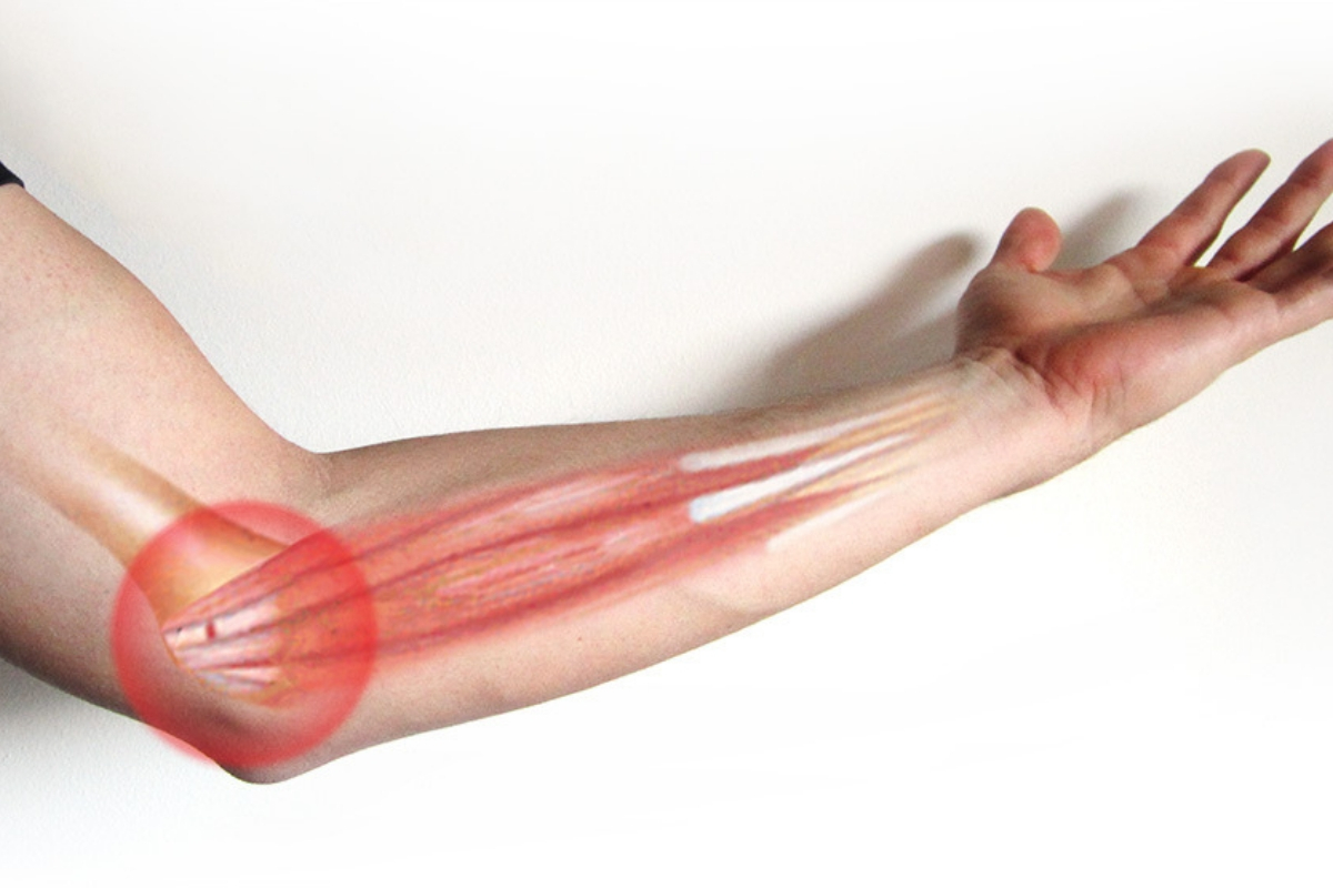 Những điều cần biết về bệnh thoái hóa khớp khuỷu tay